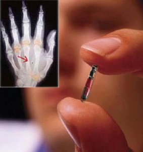 Microchip é implantado com uma seringa e substitui crachá de identificação na Suécia (BioNyfiken/Divulgação)